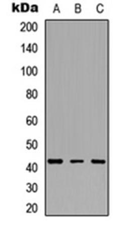 Western blot analysis of HeLa (Lane 1), Jurkat (Lane 2), PC12 (Lane 3) whole cell lysates using IDH3 beta antibody