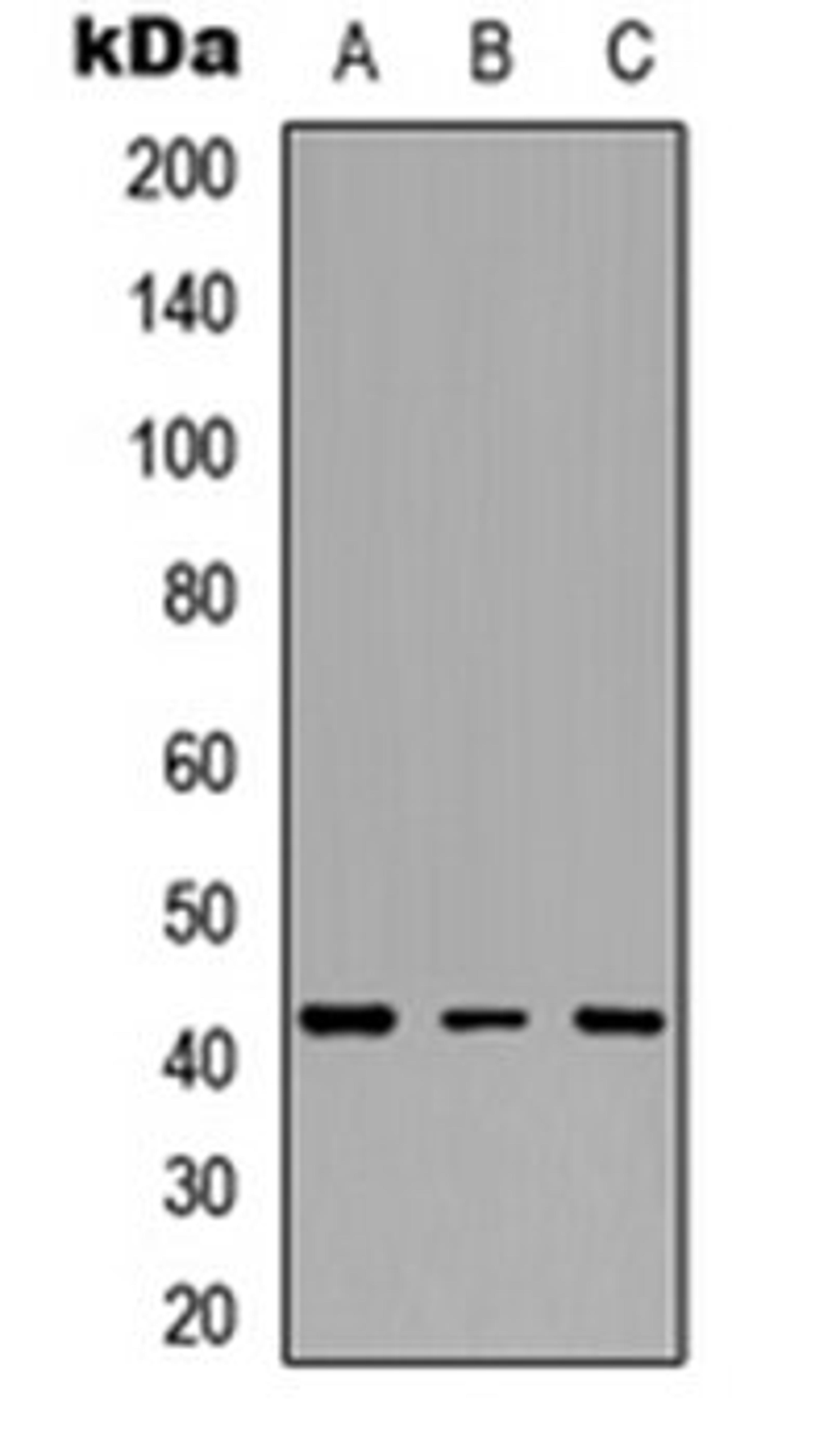 Western blot analysis of HeLa (Lane 1), Jurkat (Lane 2), PC12 (Lane 3) whole cell lysates using IDH3 beta antibody