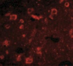 Immunofluorescence: SLITRK6 Antibody [NBP1-76876] - Human Brain cells with Slitrk6 antibody at 20 ug/mL.