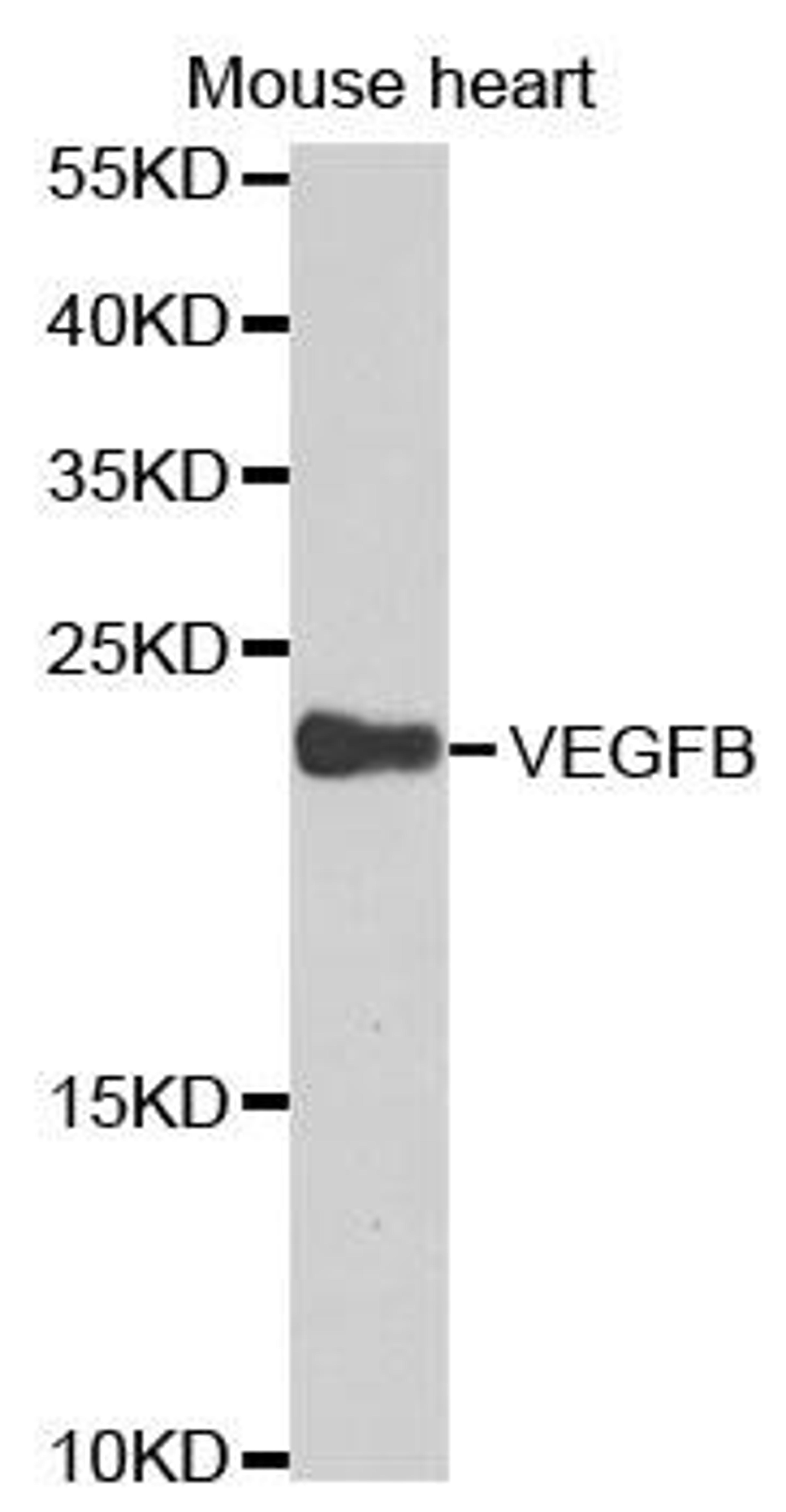 Western blot analysis of extracts of mouse heart cell lines using VEGFB antibody