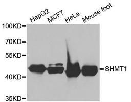 Western blot analysis of extracts of various cell lines using SHMT1 antibody