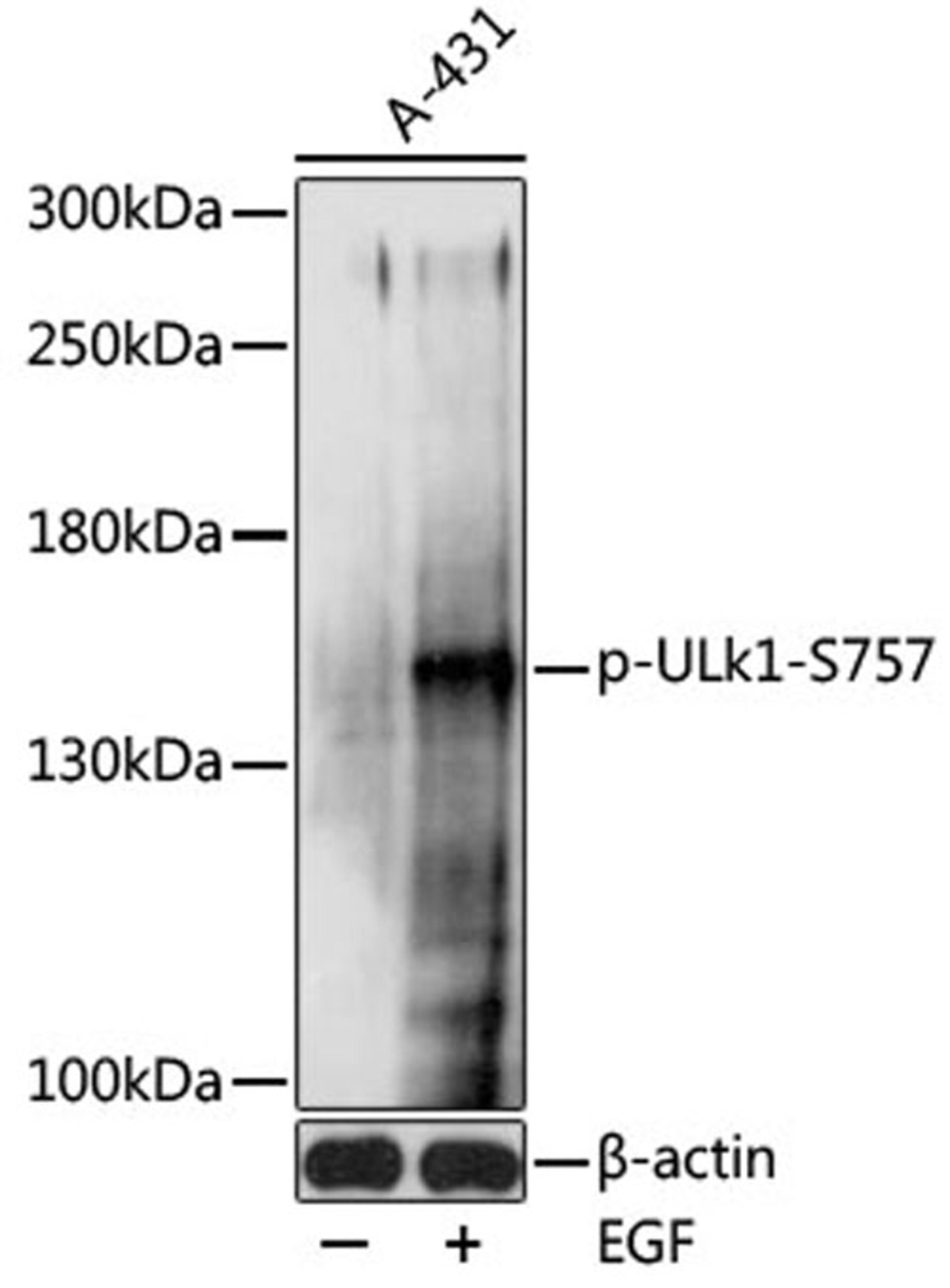 Western blot - Phospho-ULk1-S757 pAb (AP0736)