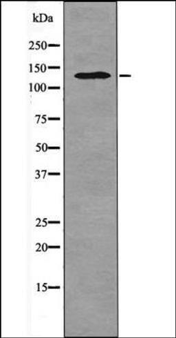 Western blot analysis of TNF- treated A2780 whole cell lysates using HIPK1/2/3 -Phospho-Tyr352/361/359- antibody