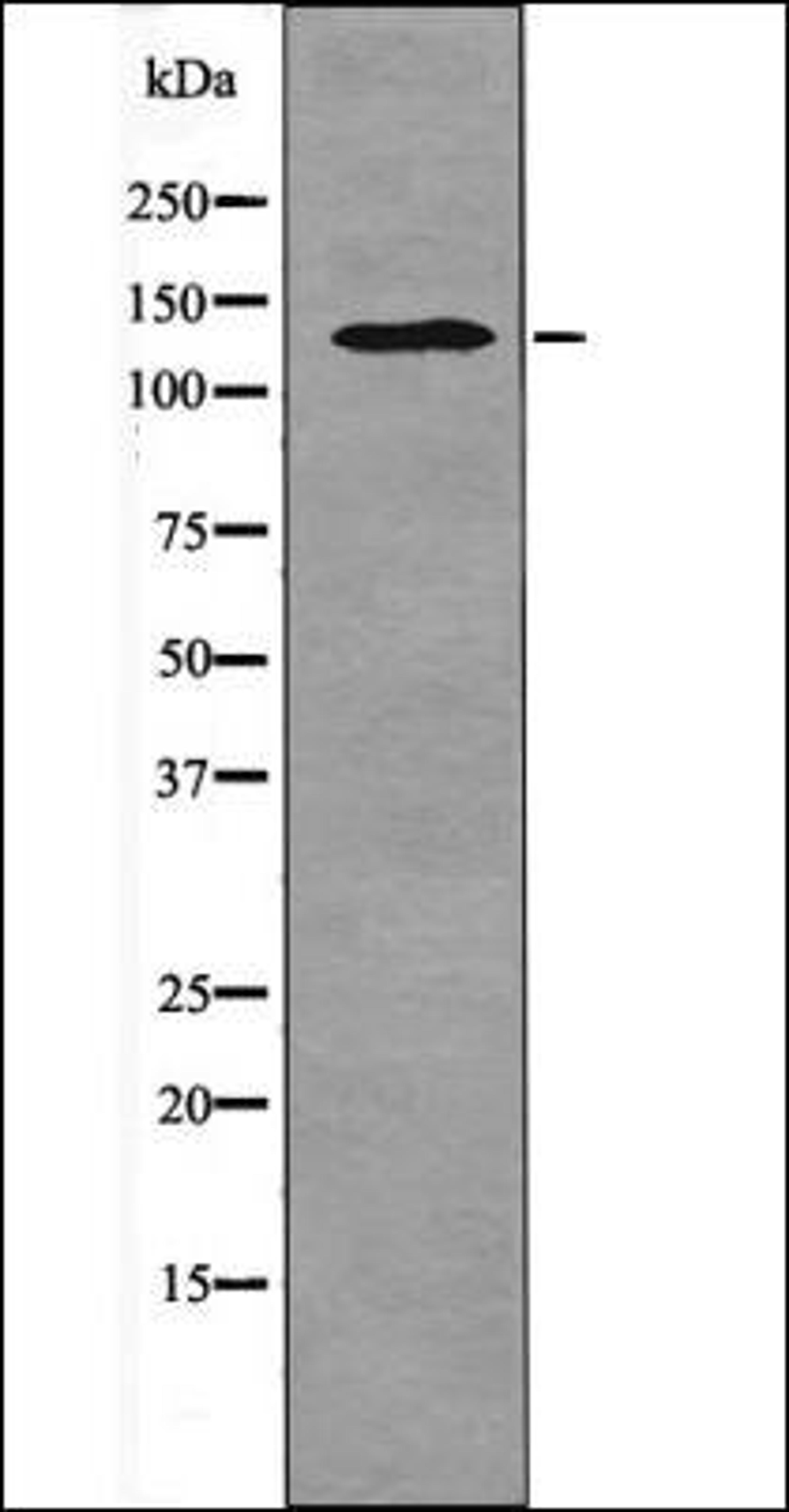 Western blot analysis of TNF- treated A2780 whole cell lysates using HIPK1/2/3 -Phospho-Tyr352/361/359- antibody