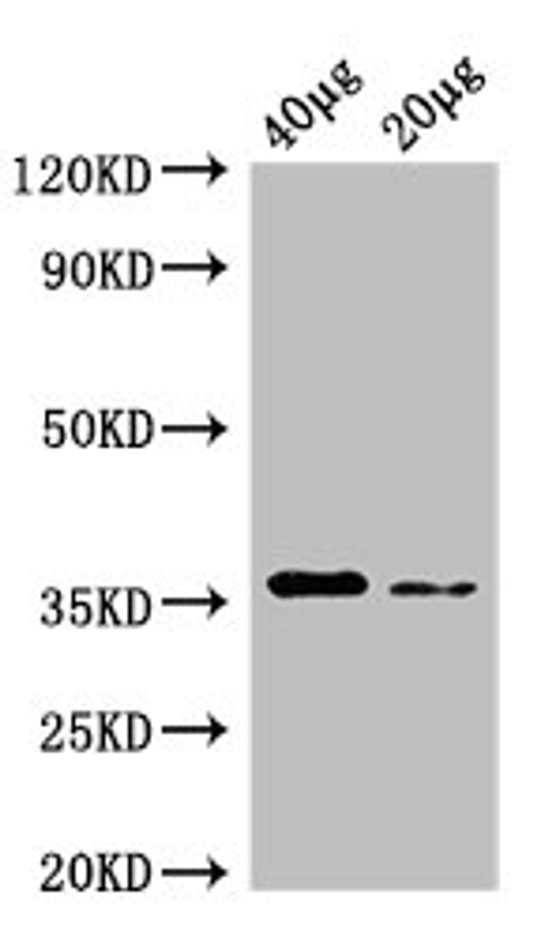 Western Blot. Positive WB detected in: Rosseta bacteria lysate at 40µg, 20µg. All lanes: dcyD antibody at 0.25µg/ml. Secondary. Goat polyclonal to rabbit IgG at 1/50000 dilution. Predicted band size: 36 kDa. Observed band size: 36 kDa