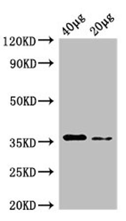 Western Blot. Positive WB detected in: Rosseta bacteria lysate at 40µg, 20µg. All lanes: dcyD antibody at 0.25µg/ml. Secondary. Goat polyclonal to rabbit IgG at 1/50000 dilution. Predicted band size: 36 kDa. Observed band size: 36 kDa