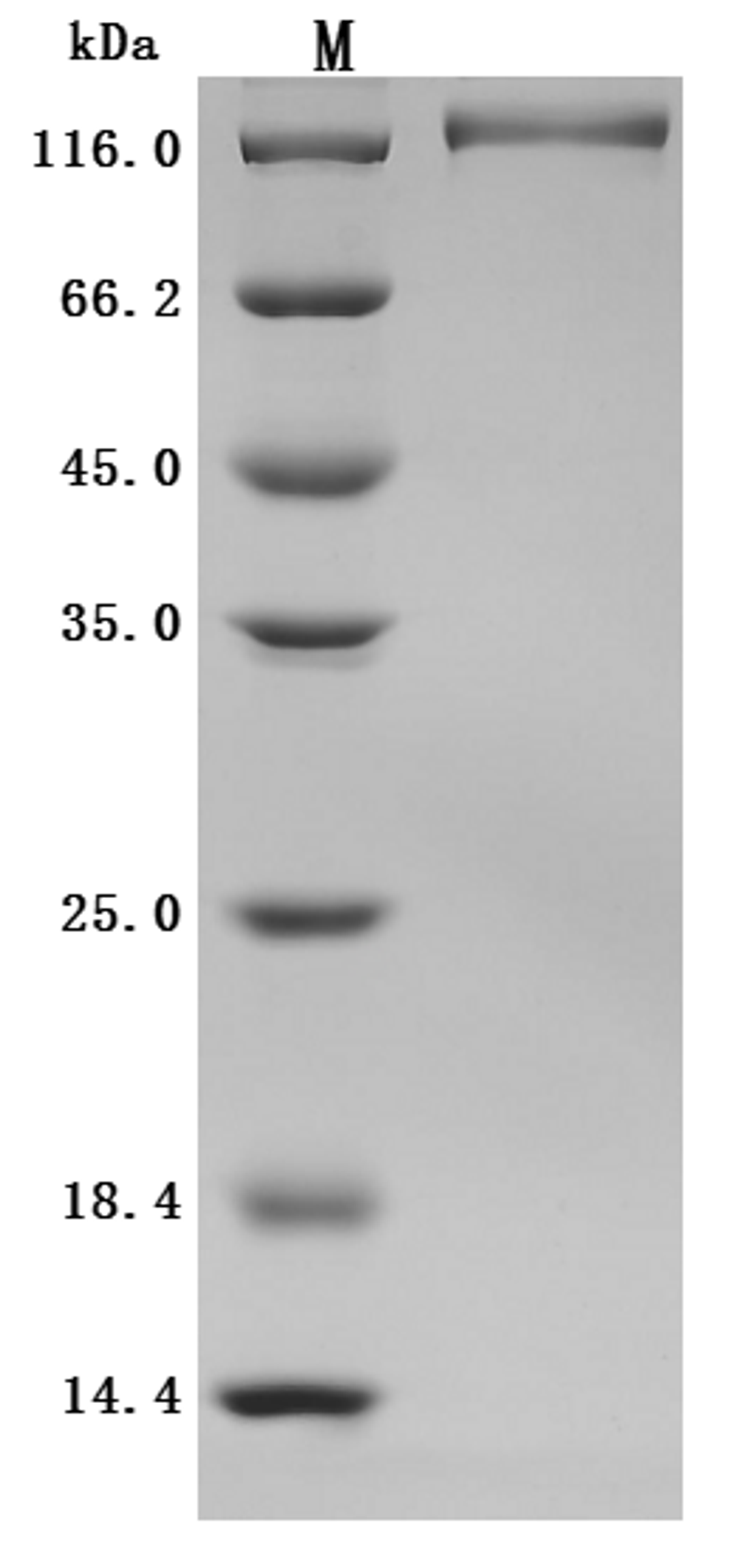 (Tris-Glycine gel) Discontinuous SDS-PAGE (reduced) with 5% enrichment gel and 15% separation gel.