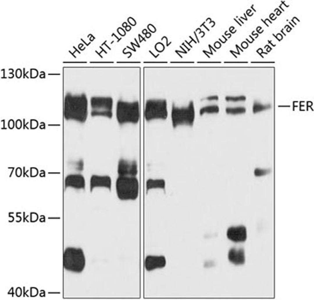 Western blot - FER antibody (A9687)