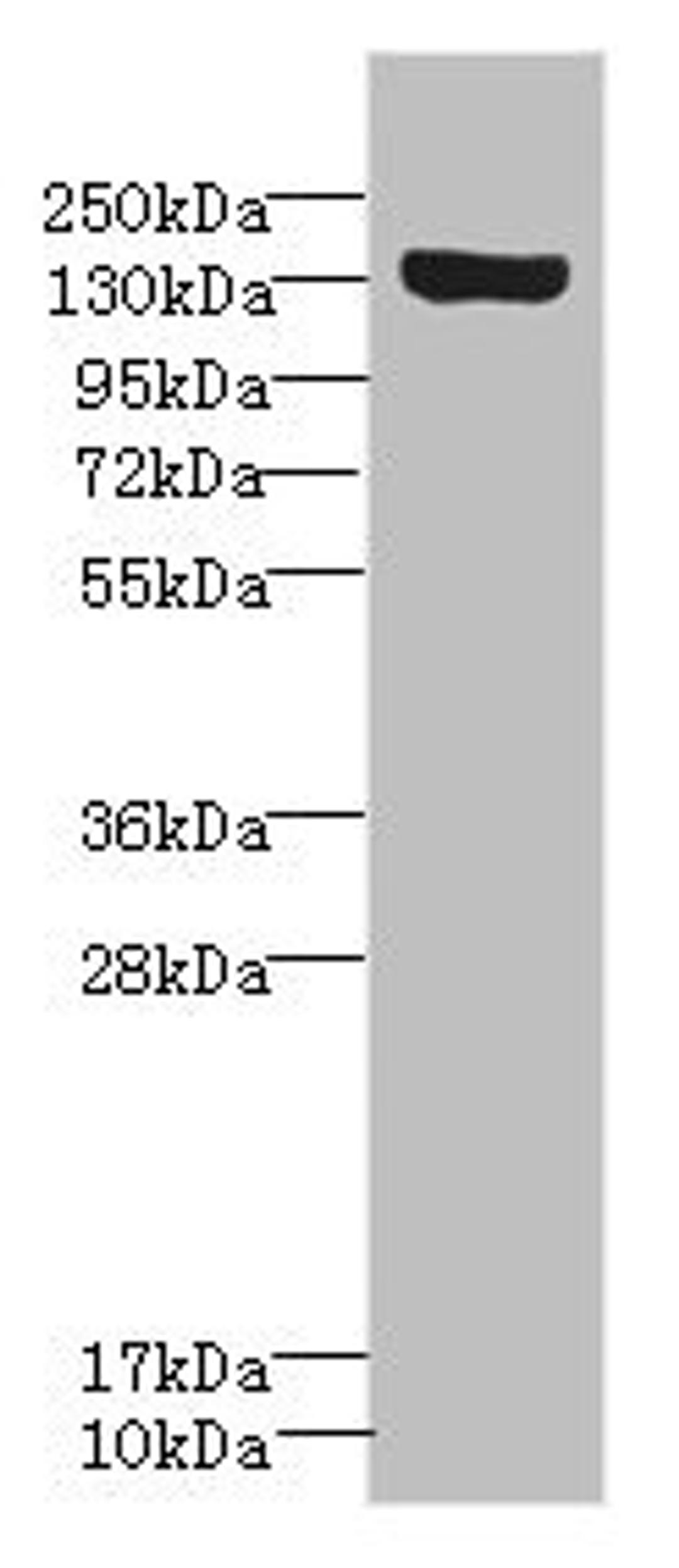 Western blot. All lanes: SCN8A antibody IgG at 1.18ug/ml + Rat heart tissue. Secondary. Goat polyclonal to rabbit IgG at 1/10000 dilution. Predicted band size: 226, 227, 146, 221 kDa. Observed band size: 226 kDa. 