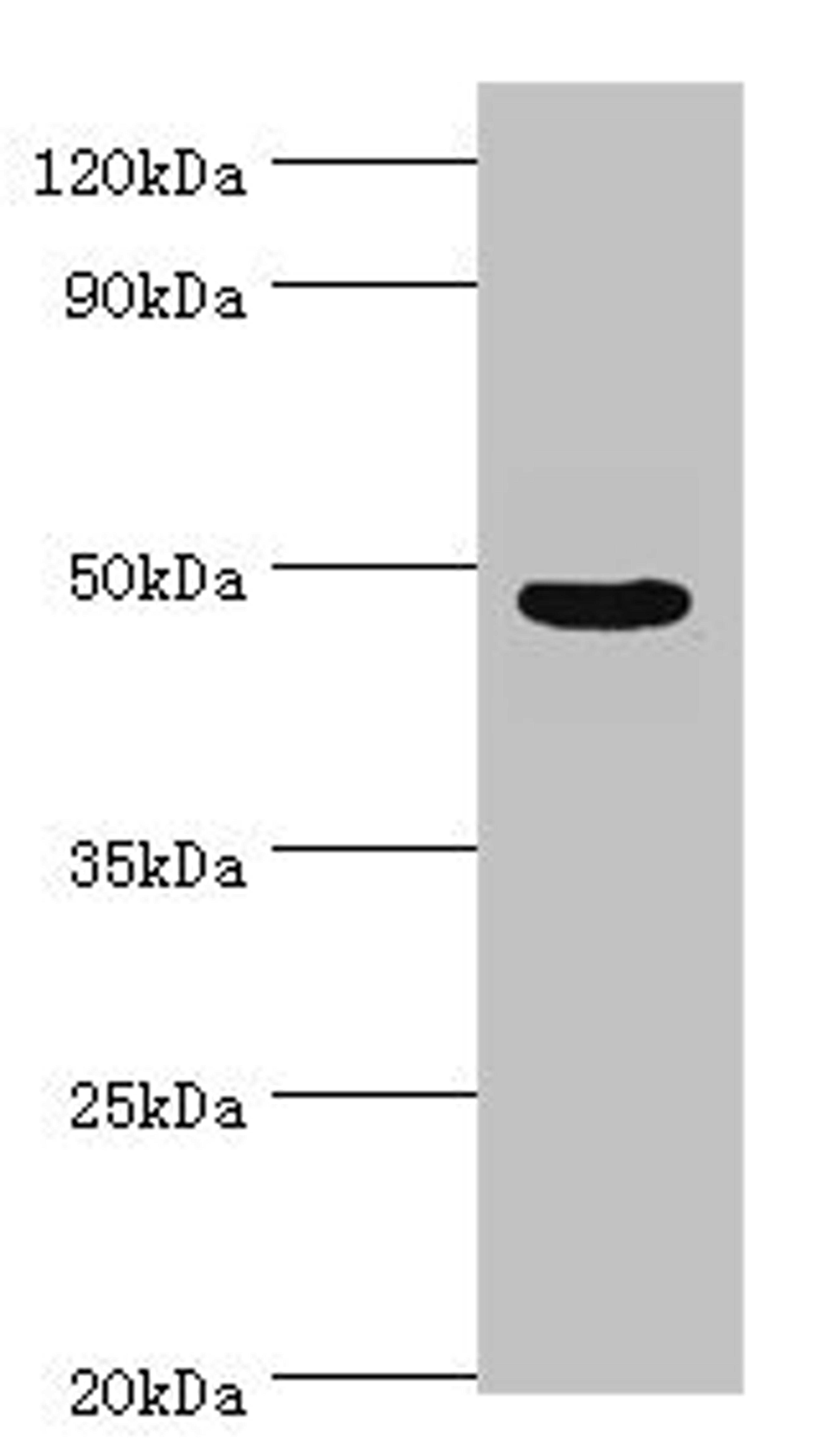 Western blot. All lanes: Evolutionarily conserved signaling intermediate in Toll pathway, mitochondrial antibody at 10ug/ml + Jurkat whole cell lysate. Secondary. Goat polyclonal to rabbit IgG at 1/10000 dilution. Predicted band size: 50, 34, 25 kDa. Observed band size: 50 kDa. 