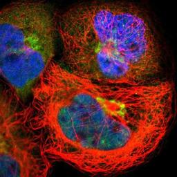 Immunocytochemistry/Immunofluorescence: CBX4 Antibody [NBP1-83225] Staining of human cell line A-431 shows positivity in nucleus but not nucleoli, cytoplasm & golgi apparatus.