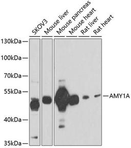 Western blot - AMY1A antibody (A6867)