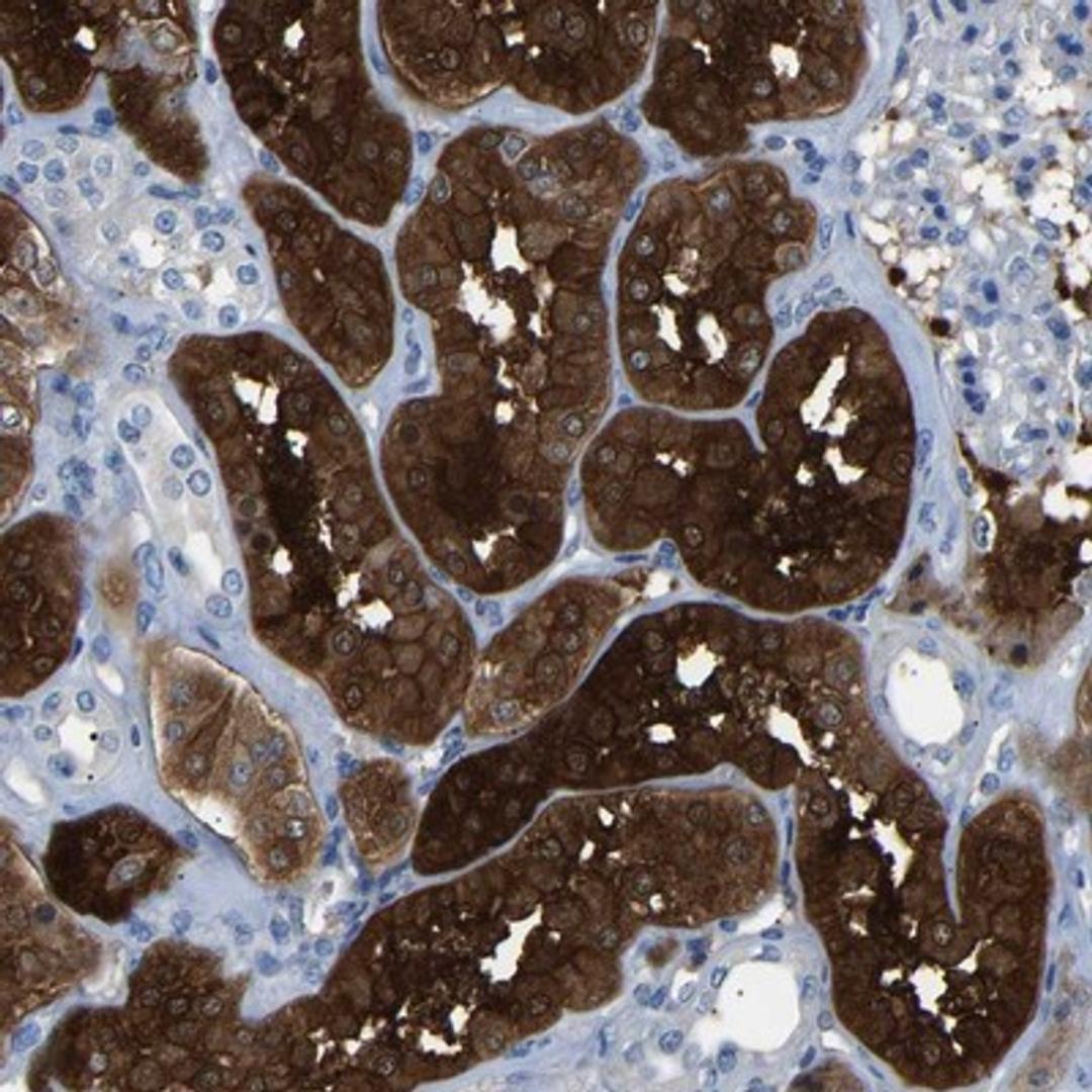 Immunohistochemistry-Paraffin: HEATR2 Antibody [NBP1-82183] - Staining of human kidney shows strong cytoplasmic positivity in cells of tubules.