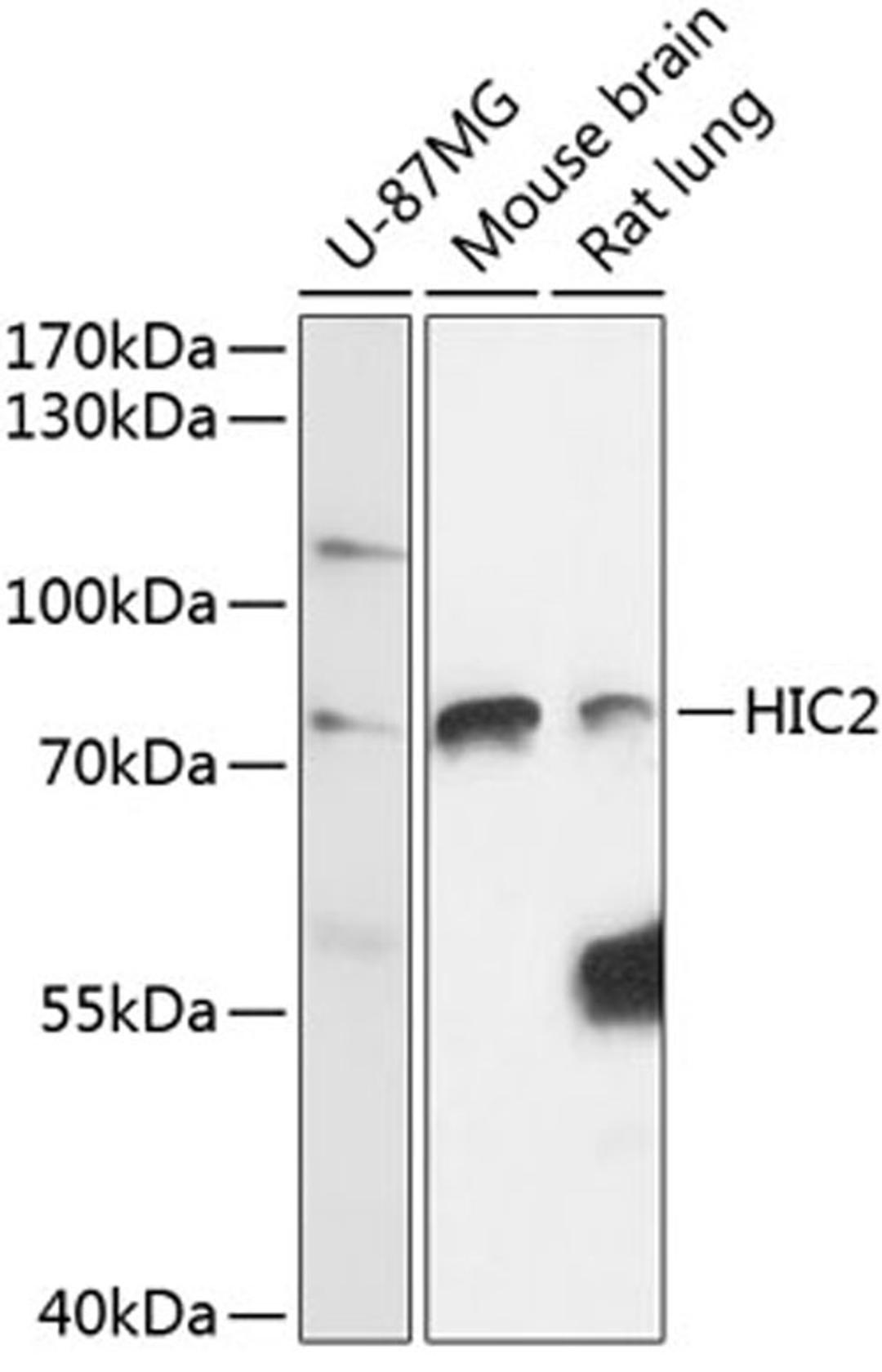 Western blot - HIC2 antibody (A14313)