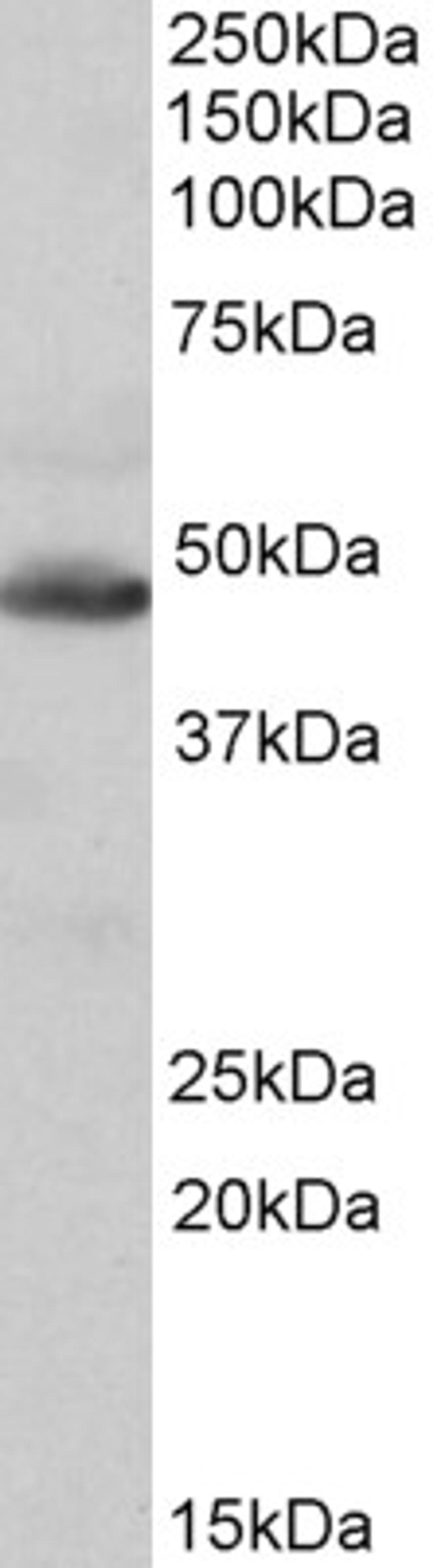 42-704 (0.1ug/ml) staining of Human Heart lysate (35ug protein in RIPA buffer). Primary incubation was 1 hour. Detected by chemiluminescence.