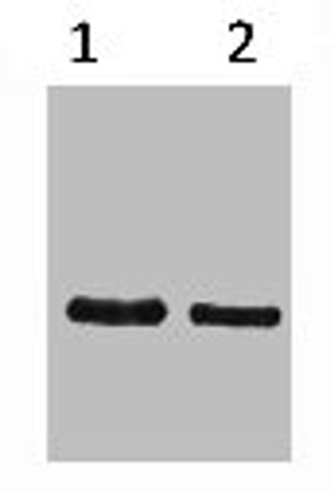 Western blot analysis of SRT-Recombinant protein, diluted at 1) 1:5000  2) 1:10000