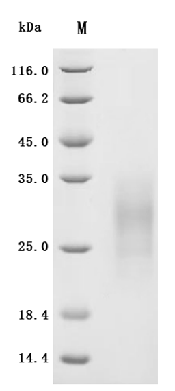 (Tris-Glycine gel) Discontinuous SDS-PAGE (reduced) with 5% enrichment gel and 15% separation gel.