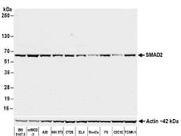 Detection of mouse SMAD2 by western blot.