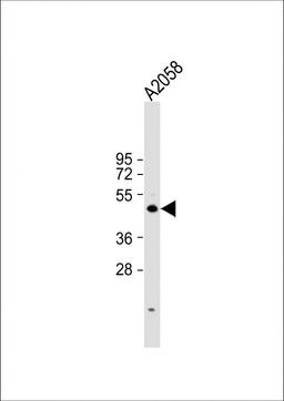 Western Blot at 1:1000 dilution + A2058 whole cell lysate Lysates/proteins at 20 ug per lane.