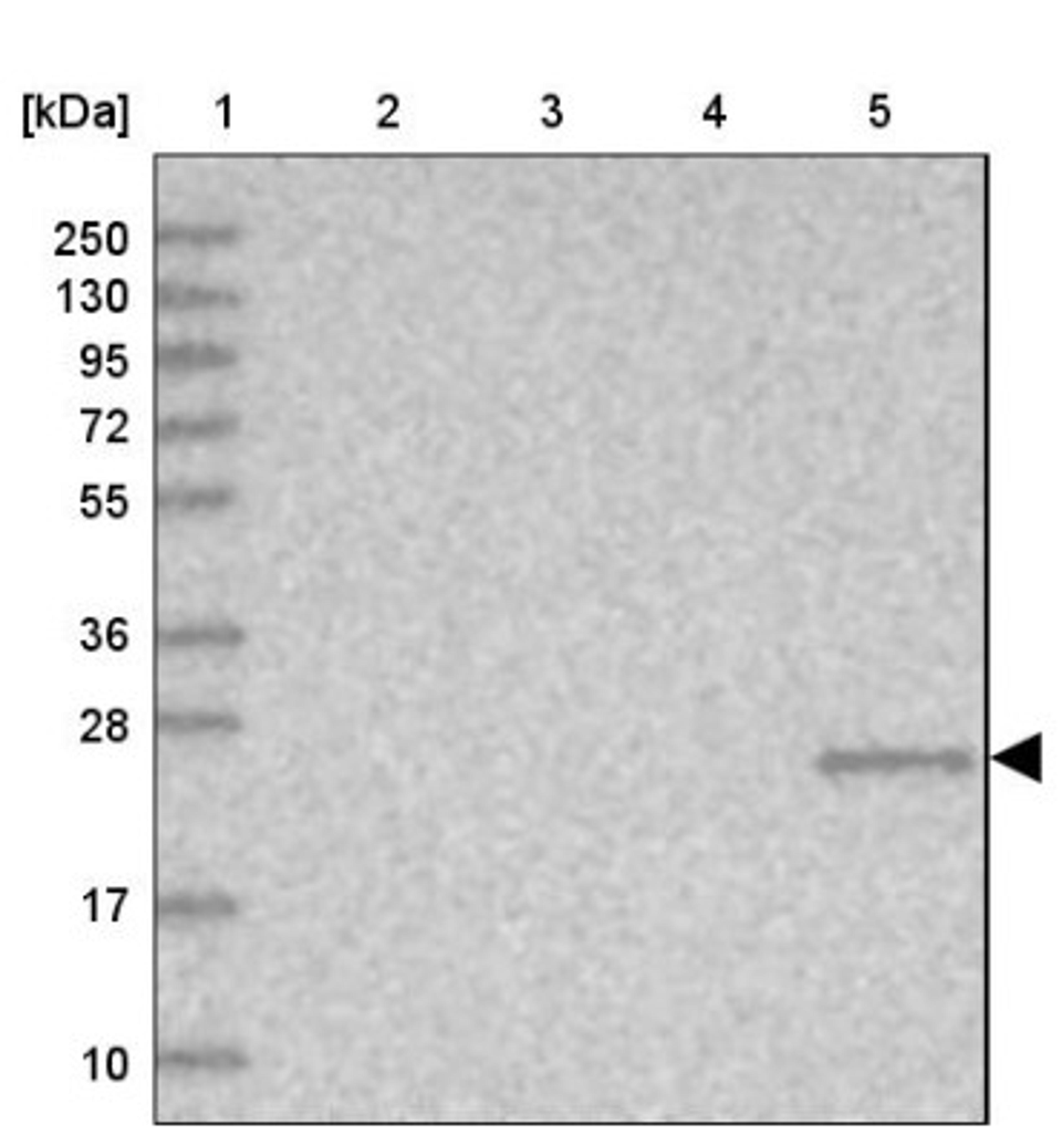 Western Blot: TTC36 Antibody [NBP1-93702] - Lane 1: Marker [kDa] 250, 130, 95, 72, 55, 36, 28, 17, 10<br/>Lane 2: Human cell line RT-4<br/>Lane 3: Human cell line U-251MG sp<br/>Lane 4: Human plasma (IgG/HSA depleted)<br/>Lane 5: Human liver tissue