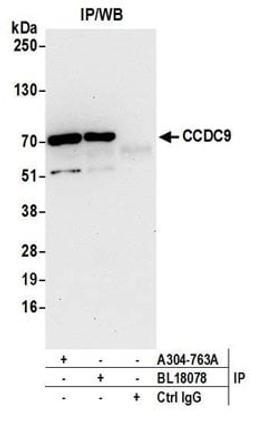 Detection of human CCDC9 by western blot of immunoprecipitates.