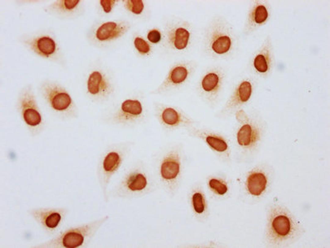Immunocytochemistry analysis of CSB-PA010429OA79acHU diluted at 1:10 and staining in Hela cells (treated with 30mM sodium butyrate for 4h) performed on a Leica BondTM system. The cells were fixed in 4% formaldehyde, permeabilized using 0.2% Triton X-100 and blocked with 10% normal goat serum 30min at RT. Then primary antibody (1% BSA) was incubated at 4&deg;C overnight. The primary is detected by a biotinylated secondary antibody and visualized using an HRP conjugated SP system.