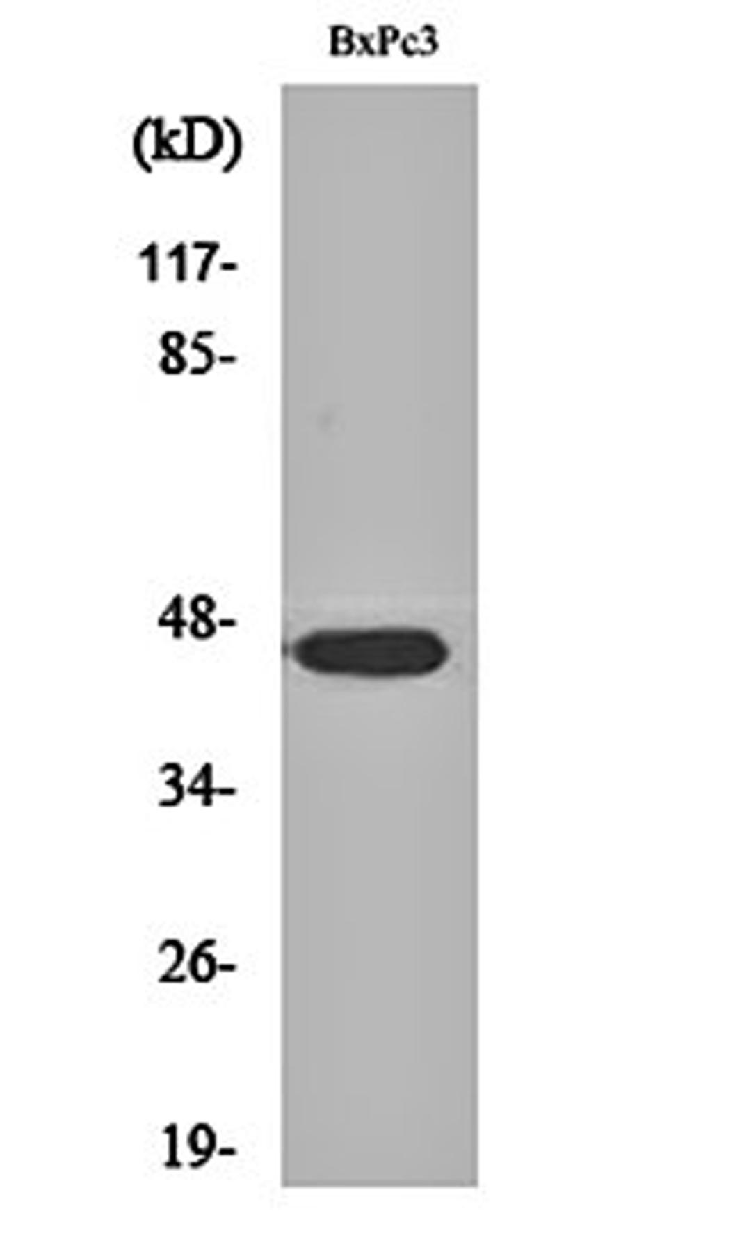 Western blot analysis of BxPc3 cell lysates using AR- beta 2 antibody