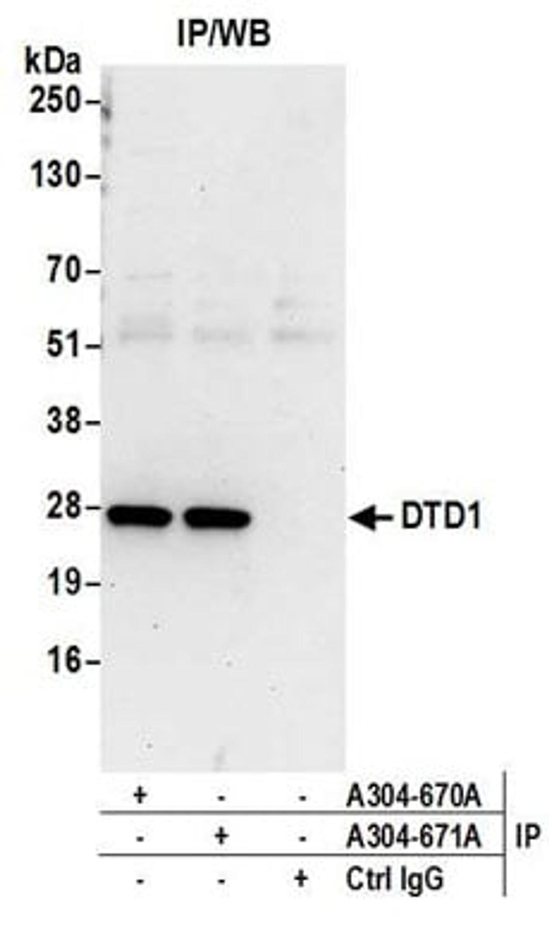 Detection of human DTD1 by western blot of immunoprecipitates.