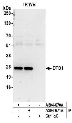 Detection of human DTD1 by western blot of immunoprecipitates.