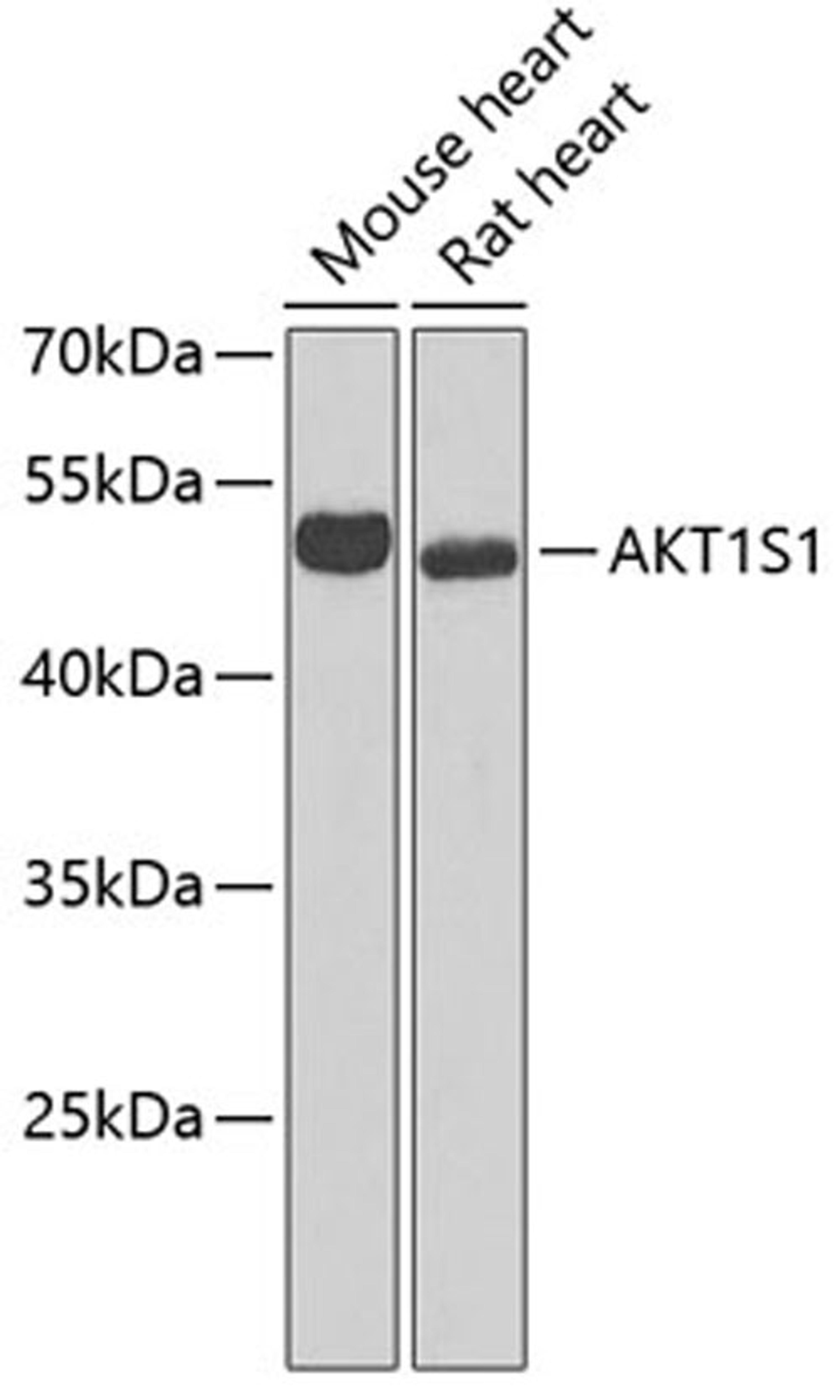 Western blot - AKT1S1 antibody (A6238)