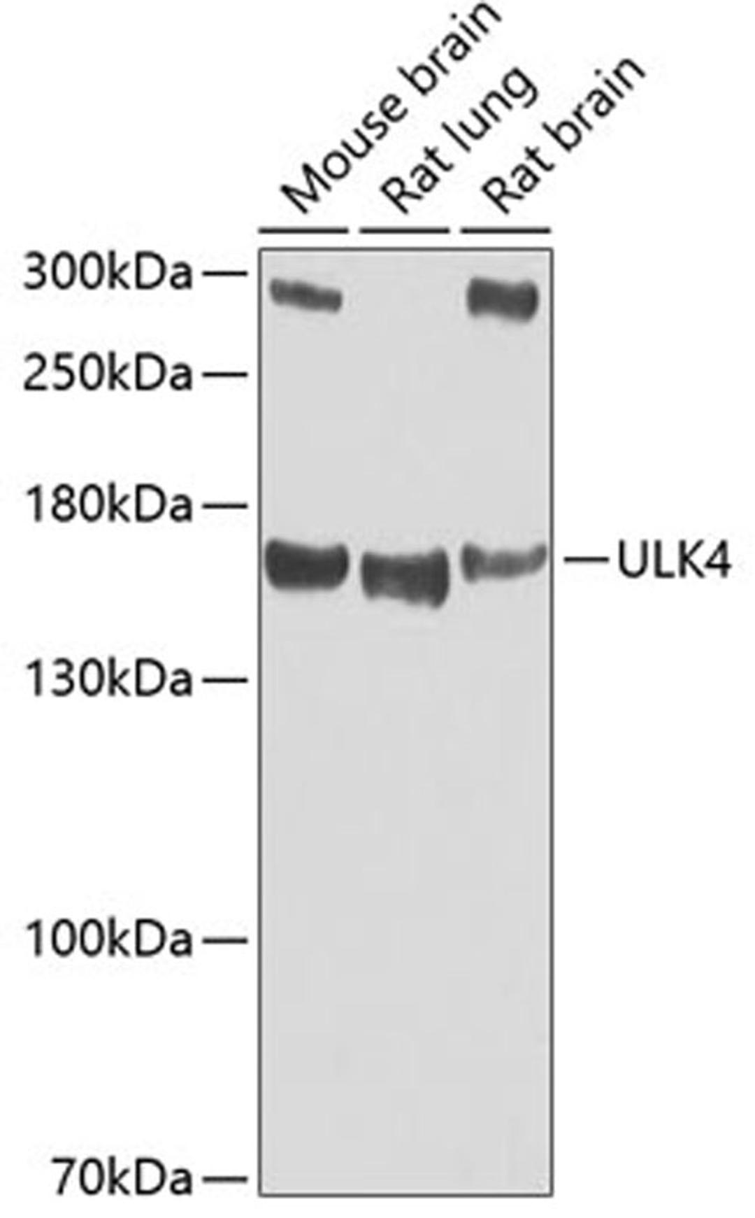 Western blot - ULK4 antibody (A7471)