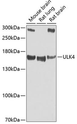 Western blot - ULK4 antibody (A7471)