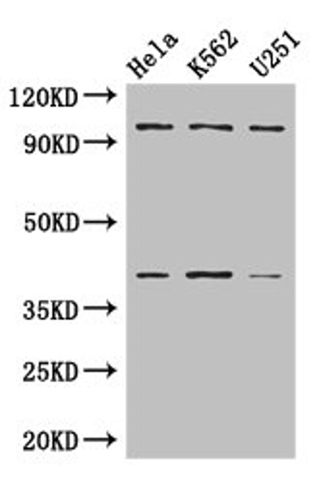 Western Blot. Positive WB detected in: Hela whole cell lysate, K562 whole cell lysate, U251 whole cell lysate. All lanes: PSMD2 antibody at 3µg/ml. Secondary. Goat polyclonal to rabbit IgG at 1/50000 dilution. Predicted band size: 101, 83, 86 kDa. Observed band size: 101, 40 kDa