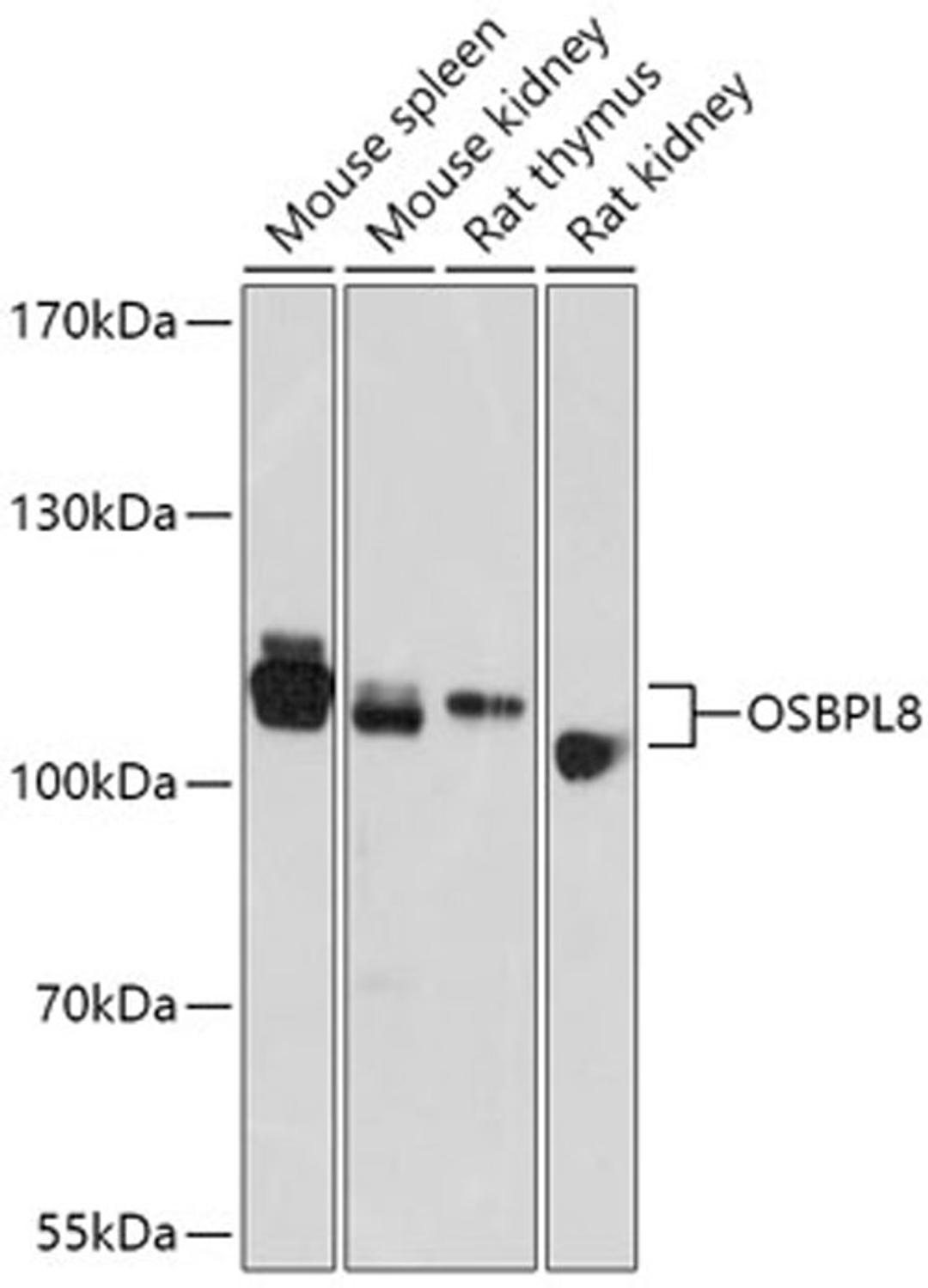 Western blot - OSBPL8 antibody (A17816)