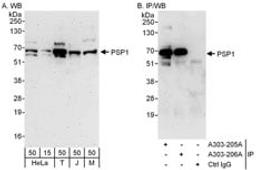 Detection of human and mouse PSP1 by western blot (h and m) and immunoprecipitation (h).