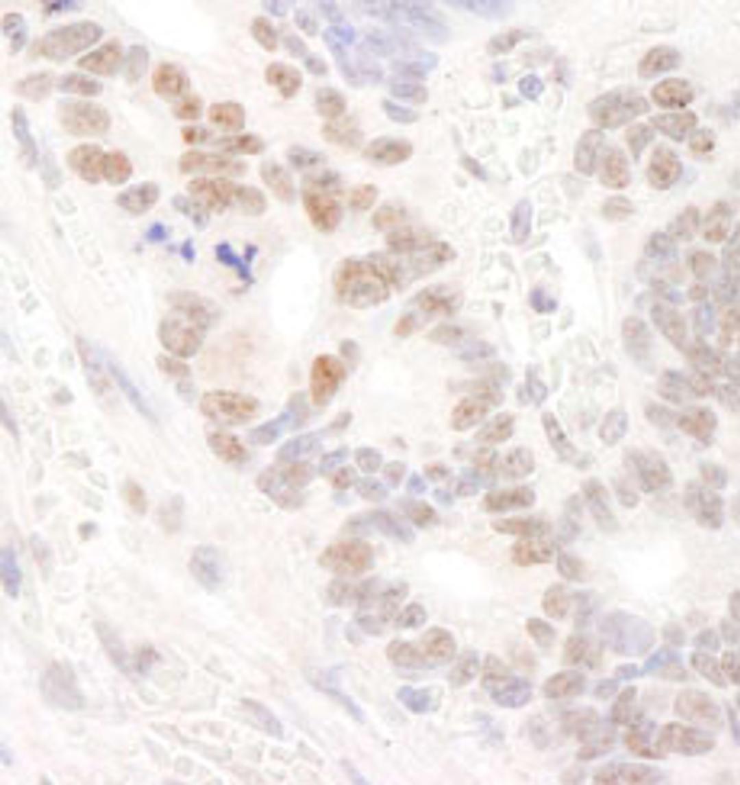 Detection of human DDX24 by immunohistochemistry.