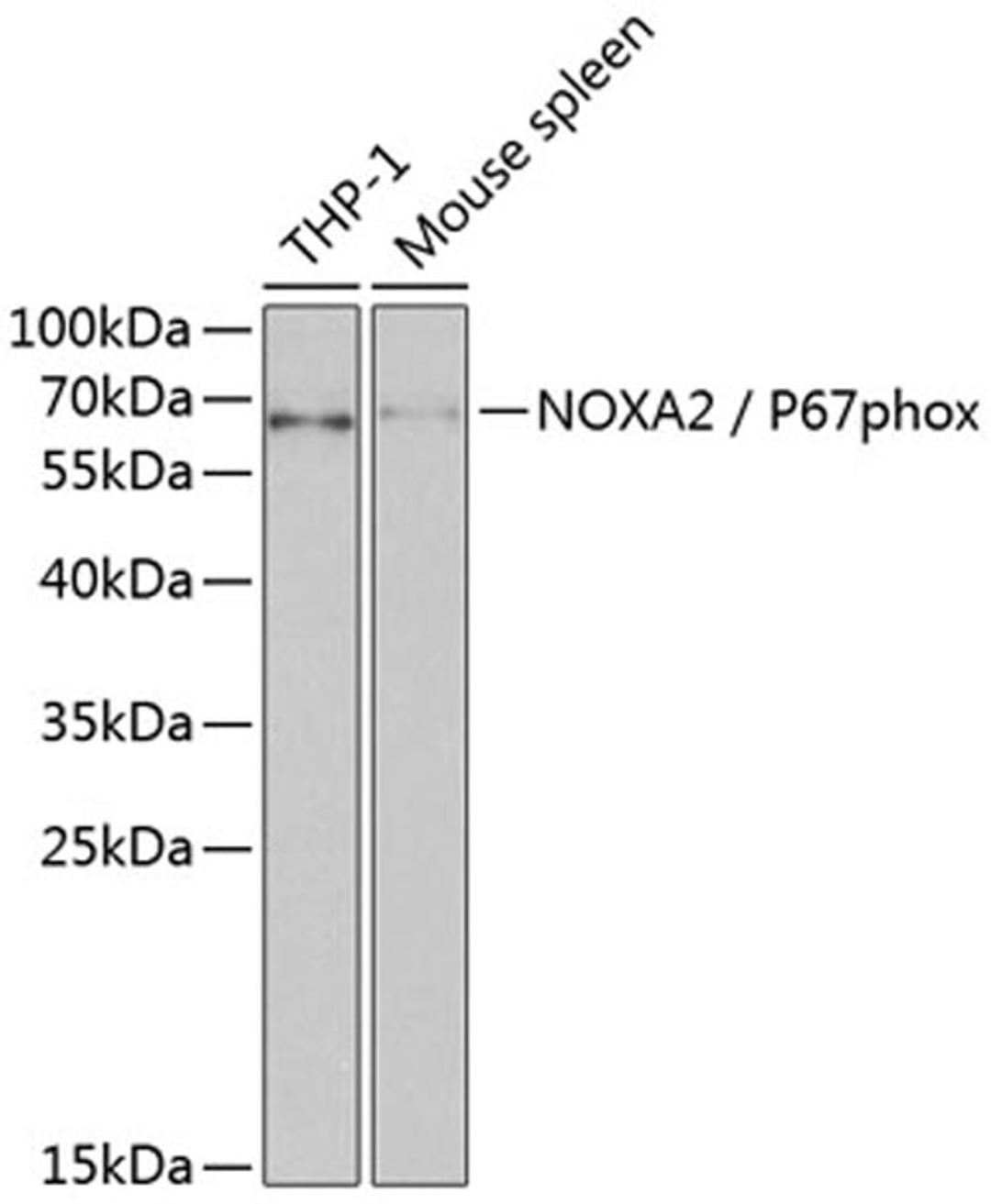 Western blot - NOXA2 / P67phox antibody (A1178)