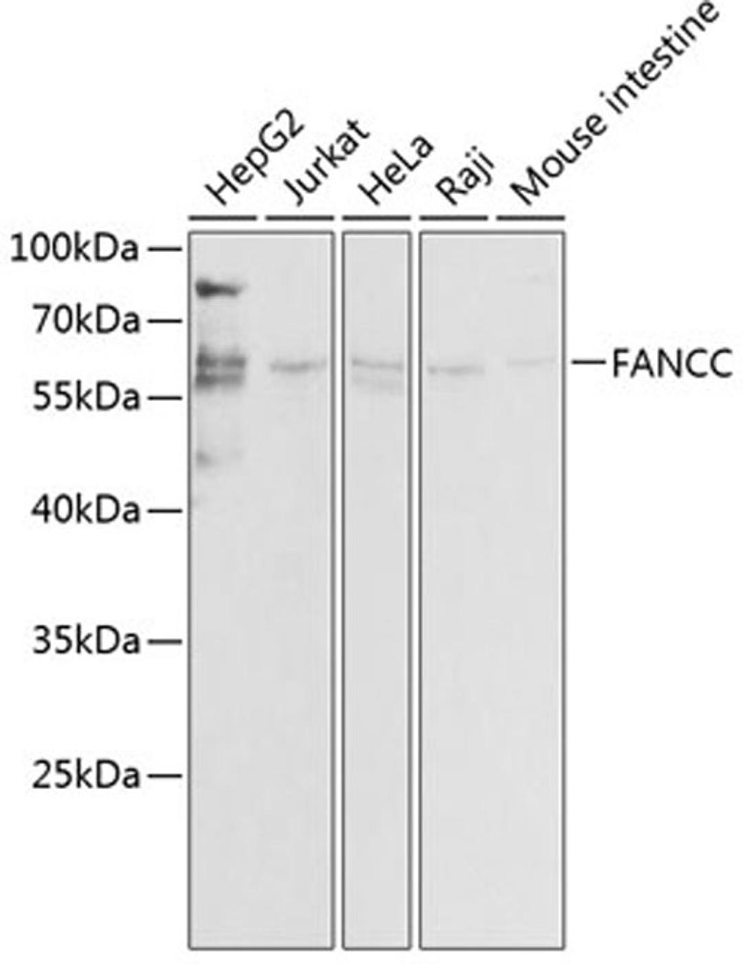 Western blot - FANCC antibody (A1812)