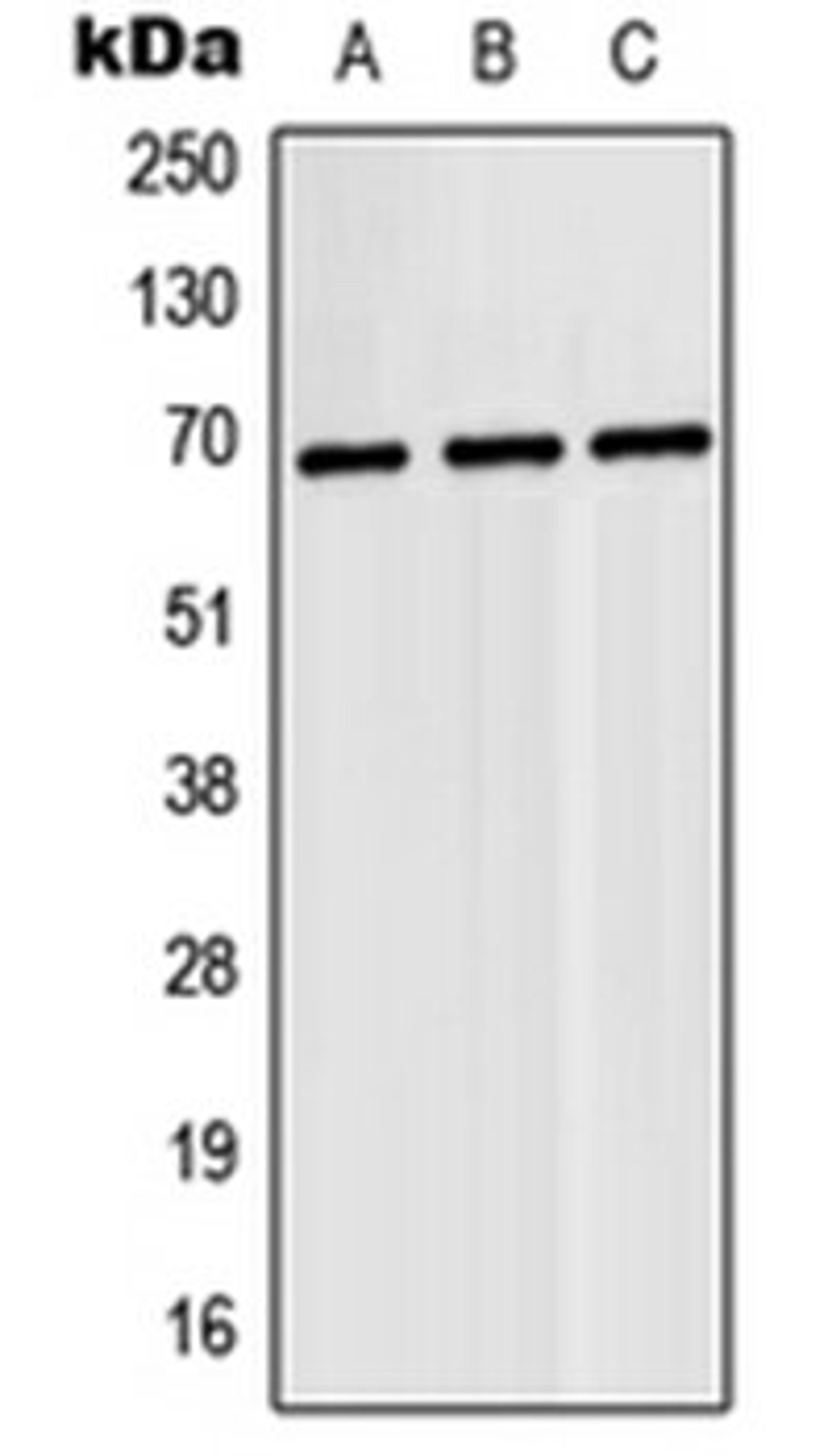 Western blot analysis of MCF7 (Lane 1), H9C2 (Lane 2), rat lung (Lane 3) whole cell lysates using N4BP2L2 antibody