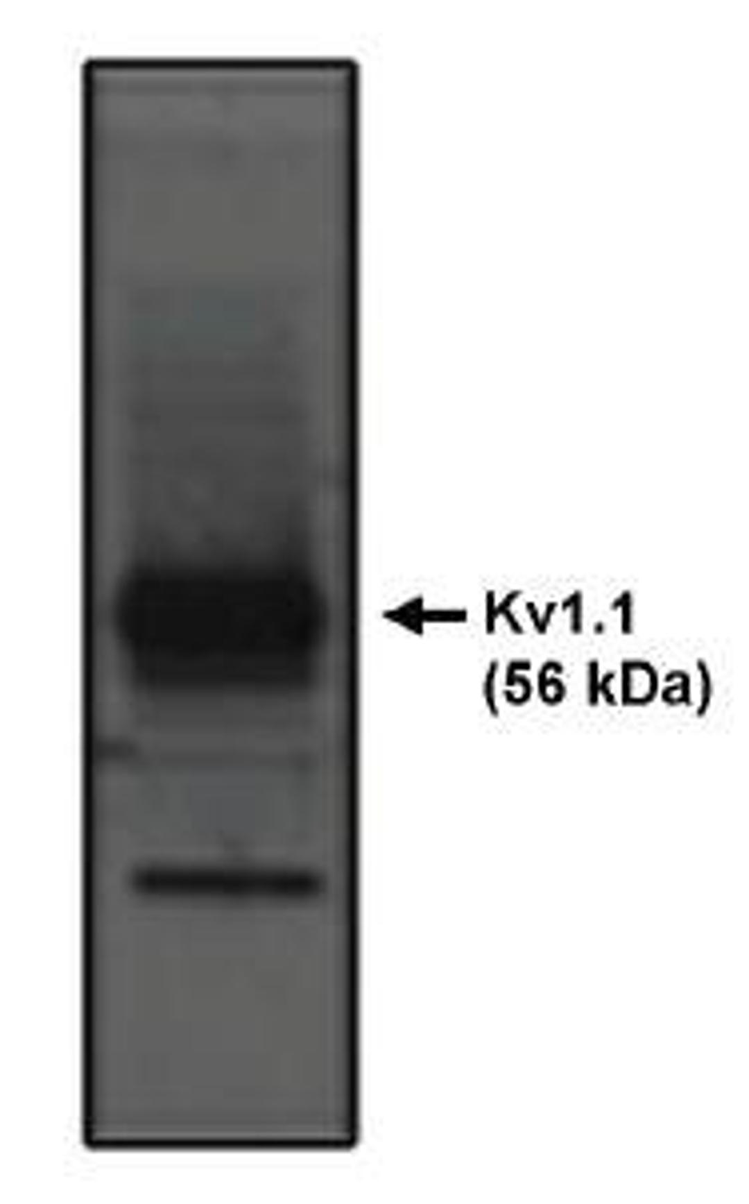 Western blot analysis of rat brain lysate using Kv1.1Potassium Channel antibody