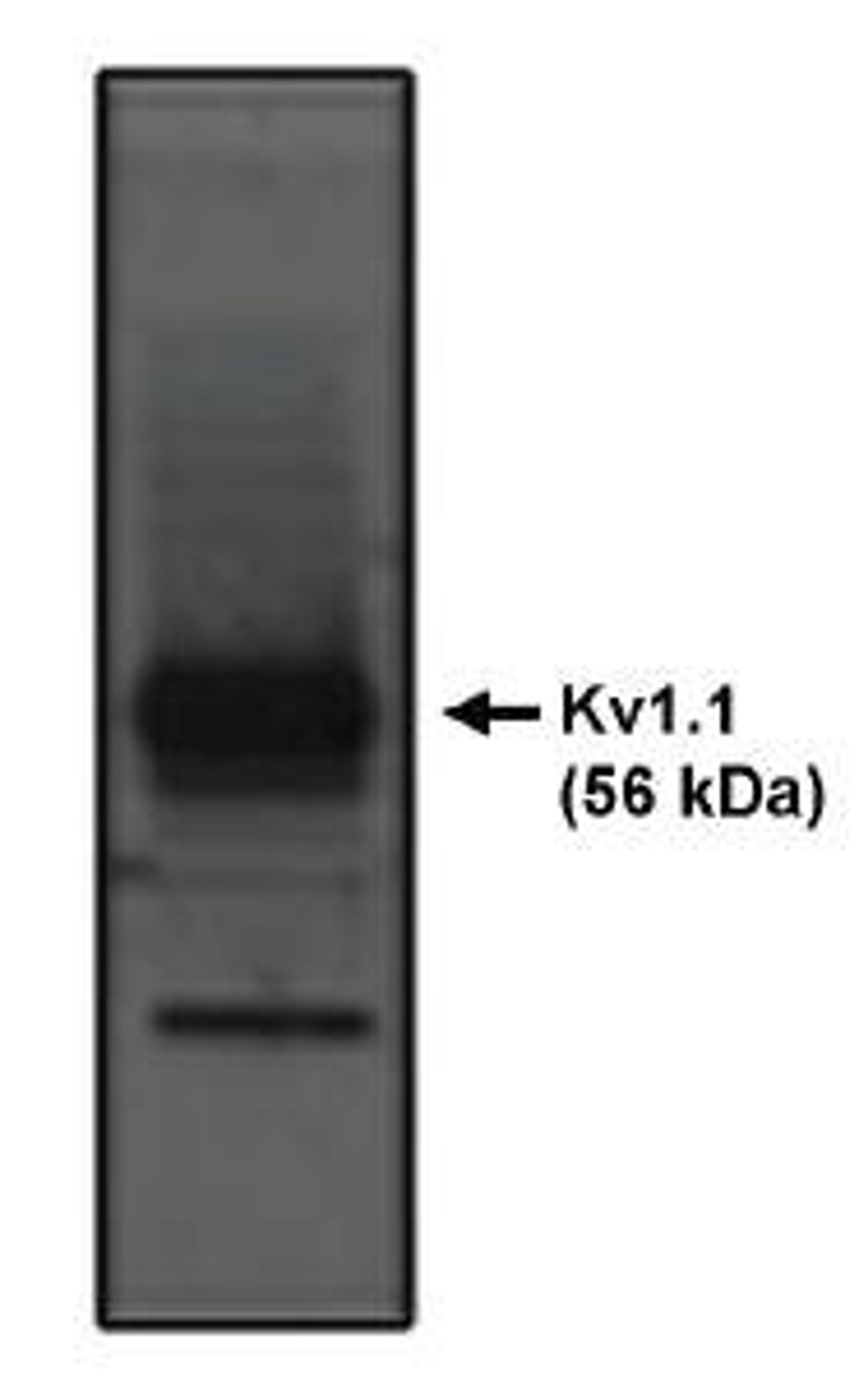 Western blot analysis of rat brain lysate using Kv1.1Potassium Channel antibody