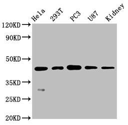 Western Blot. Positive WB detected in: Hela whole cell lysate, 293T whole cell lysate, PC3 whole cell lysate, U87 whole cell lysate, Mouse kidney tissue. All lanes: NDRG1 antibody at 0.7μg/ml. Secondary. Goat polyclonal to rabbit IgG at 1/50000 dilution. Predicted band size: 43, 36, 34 KDa. Observed band size: 43 KDa. 