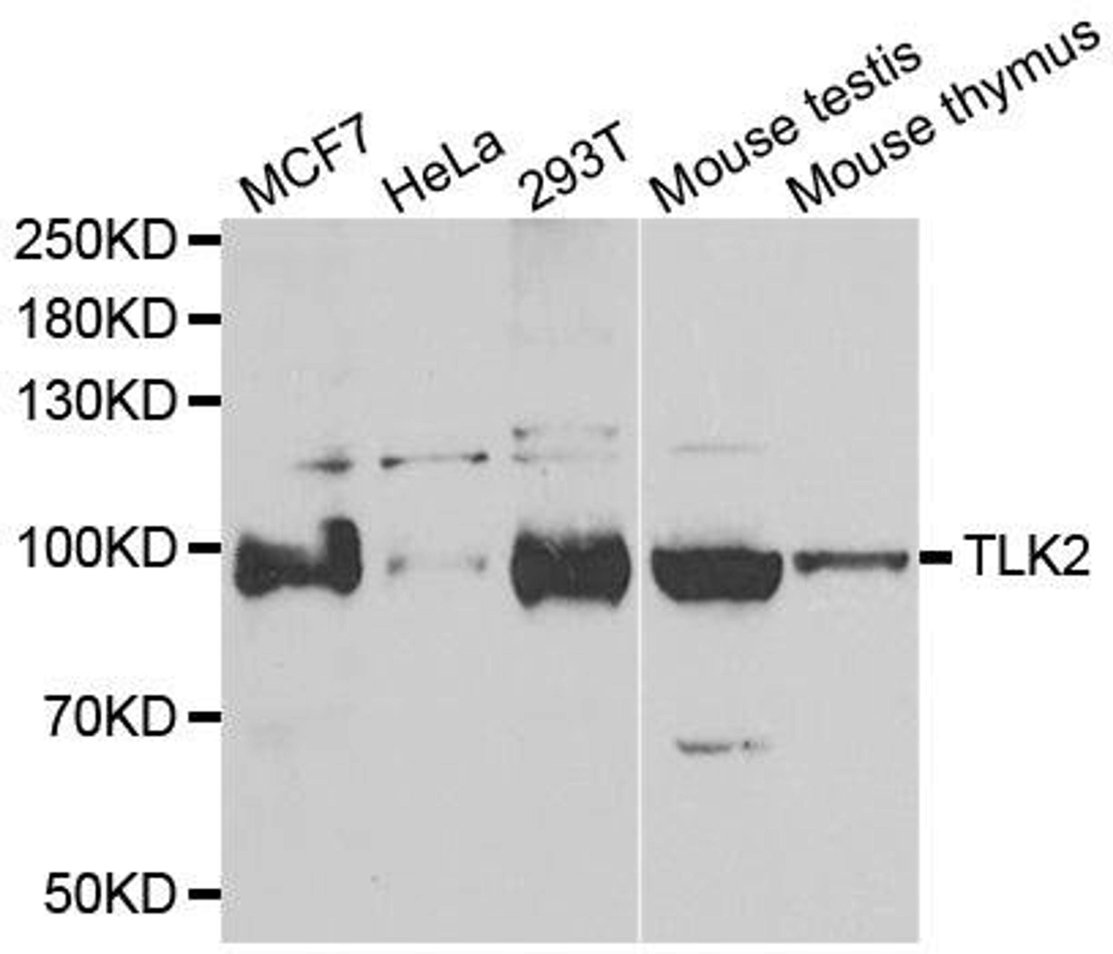 Western blot analysis of extracts of various cell lines using TLK2 antibody