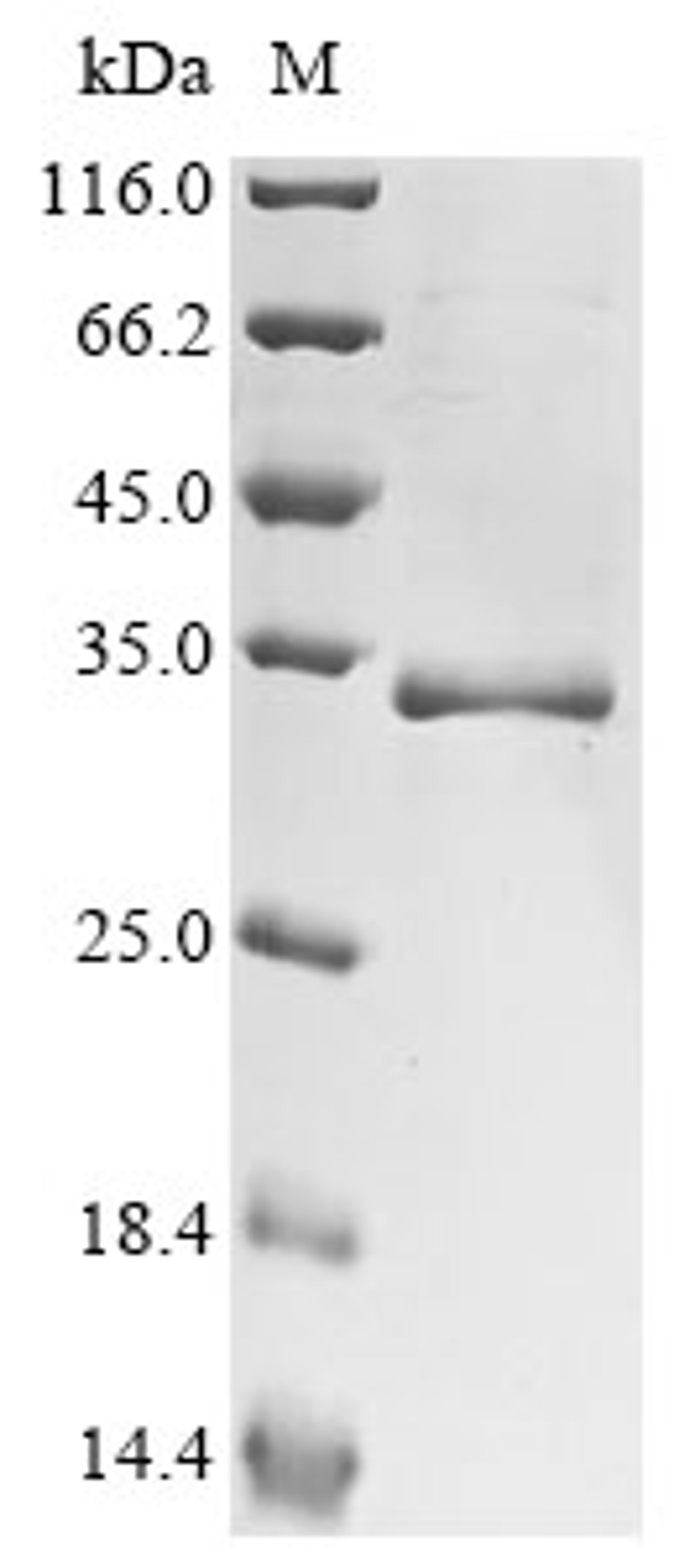 (Tris-Glycine gel) Discontinuous SDS-PAGE (reduced) with 5% enrichment gel and 15% separation gel.