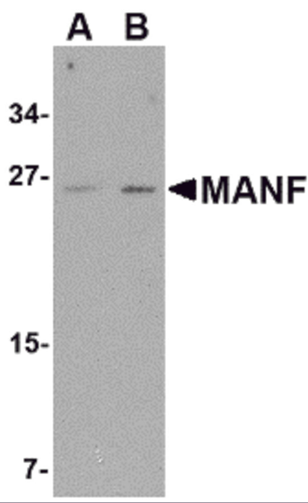 Western blot analysis of MANF in mouse brain tissue lysate with MANF antibody at (A) 1 and (B) 2 &#956;g/mL.