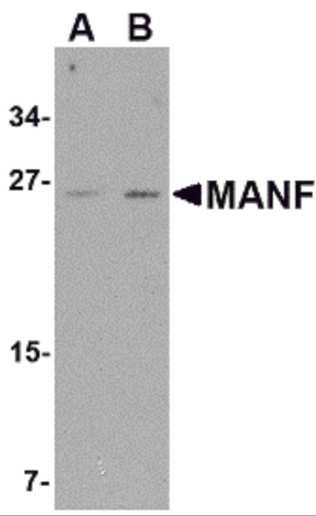 Western blot analysis of MANF in mouse brain tissue lysate with MANF antibody at (A) 1 and (B) 2 μg/mL.