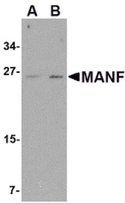 Western blot analysis of MANF in mouse brain tissue lysate with MANF antibody at (A) 1 and (B) 2 μg/mL.