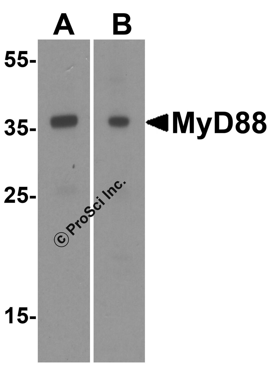 <strong>Figure 1 Western Blot Validation of MyD88 in HeLa (A) and Jurket (B) Cells</strong><br>
Loading: 15 &#956;g of lysates per lane.
Antibodies: 2125 (1 &#956;g/mL) 1 h incubation at RT in 5% NFDM/TBST.
Secondary: Goat anti-rabbit IgG HRP conjugate at