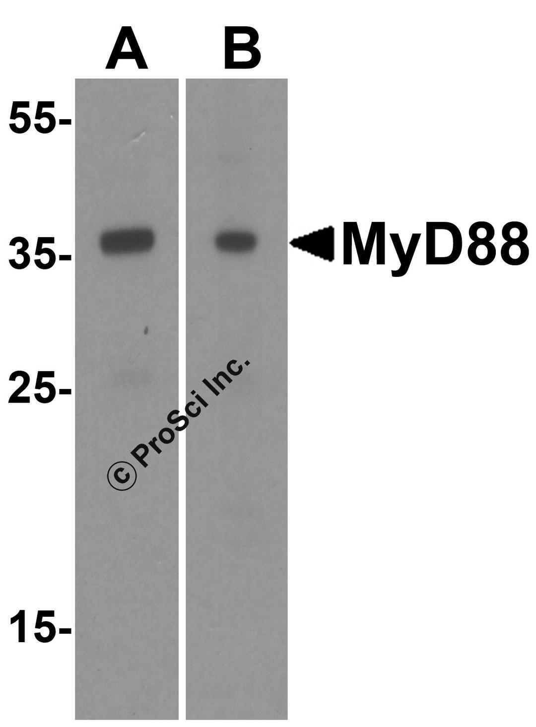 <strong>Figure 1 Western Blot Validation of MyD88 in HeLa (A) and Jurket (B) Cells</strong><br>
Loading: 15 μg of lysates per lane.
Antibodies: 2125 (1 μg/mL) 1 h incubation at RT in 5% NFDM/TBST.
Secondary: Goat anti-rabbit IgG HRP conjugate at