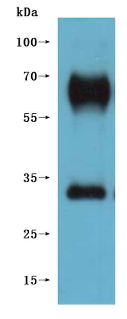 CSB-MP5431MOV is detected by Mouse anti-6*His monoclonal antibody.(This tag can be tested only under denaturing conditions.)